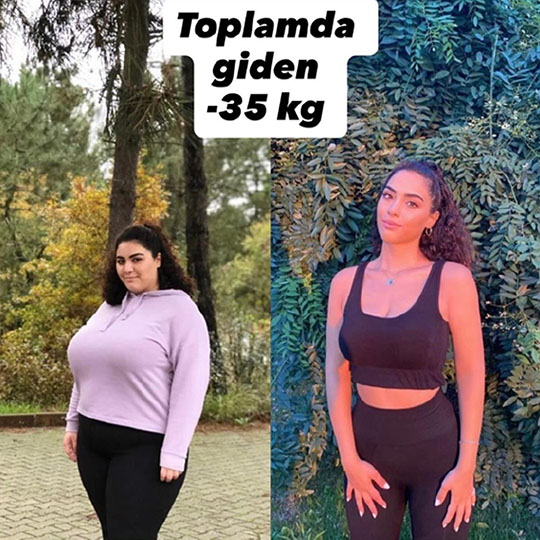 Melisa hanım - 35 kg.